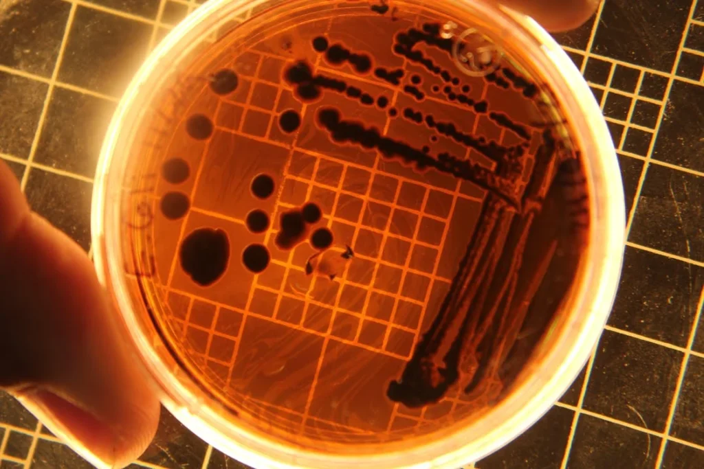 La E. coli causa Cáncer de Colon